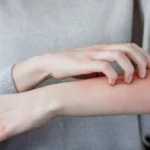 kozne-ochorenia.webp.webp